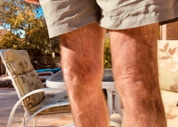 ¿La suplementación con colágeno ayuda con la artritis de rodilla?