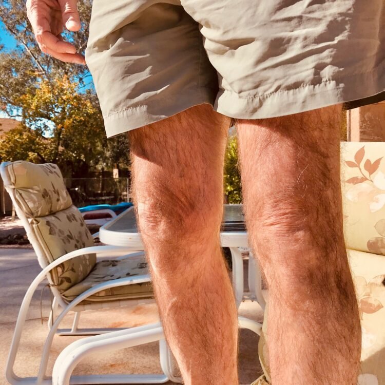 ¿La suplementación con colágeno ayuda con la artritis de rodilla?